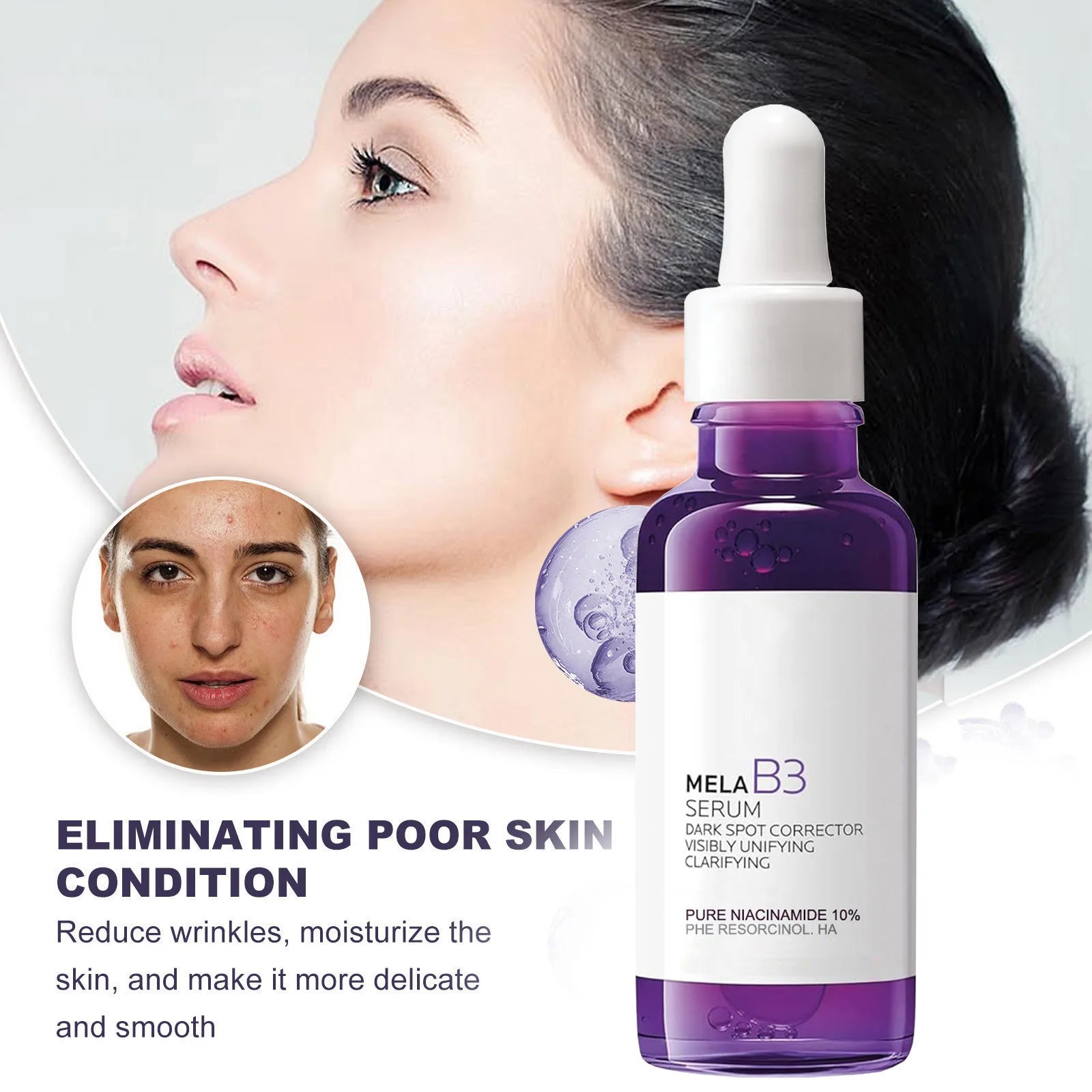 B5/B3 Anti Wrinkles Serum Pure Hyaluronic Acid Lift Firming Remove Dark Circle Whitening Repairs Hydrates Deeply Essence 30ML